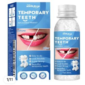 SOUTH MOON Temporary Teeth Replacement Filling Kit Moldable False Teeth Beads